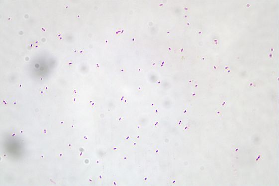 Pasteurized Akkermansia Muciniphila AKK016 AKK Off White To Light Gray Powder In Healthcare Product